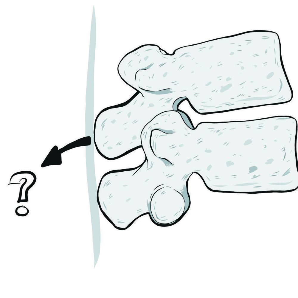 Illustration from the book showing that there is no muscle attached behind the spine capable of pulling a vertebra backwards